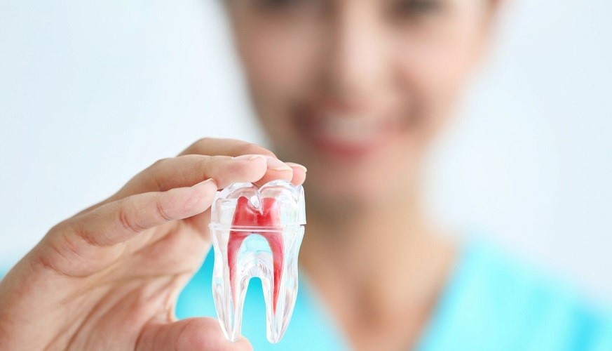 Root Canal Treatment